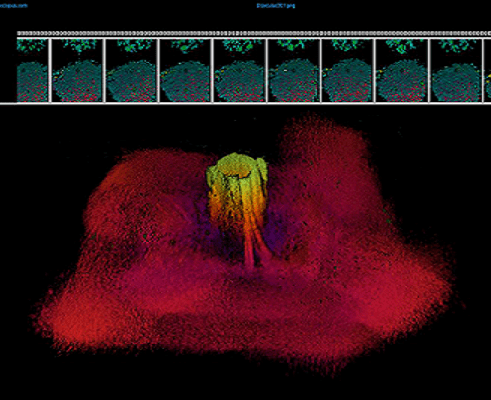 2 Echoscope